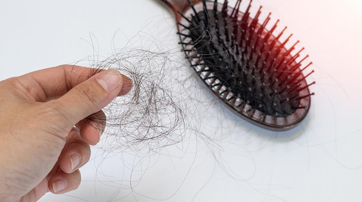 Hair Loss in India: Causes, Science, and Effective Solutions
